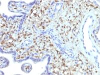 FFPE human placenta sections stained with 100 ul anti-S100A4 (clone S100A4/1481) at 1:50. HIER epitope retrieval prior to staining was performed in 10mM Citrate, pH 6.0.